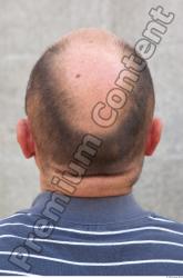 Head Hair Man Casual Slim Average Bald Street photo references